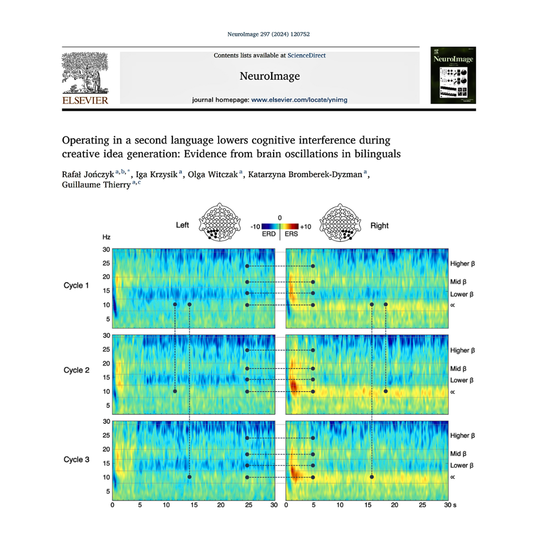 Research paper published in NeuroImage